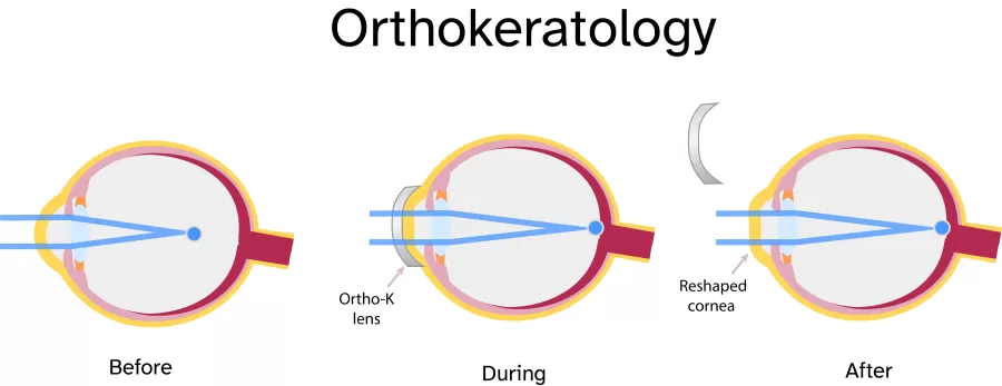 an illustration of how orthok works