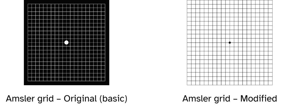 an image of two types of Amsler grids