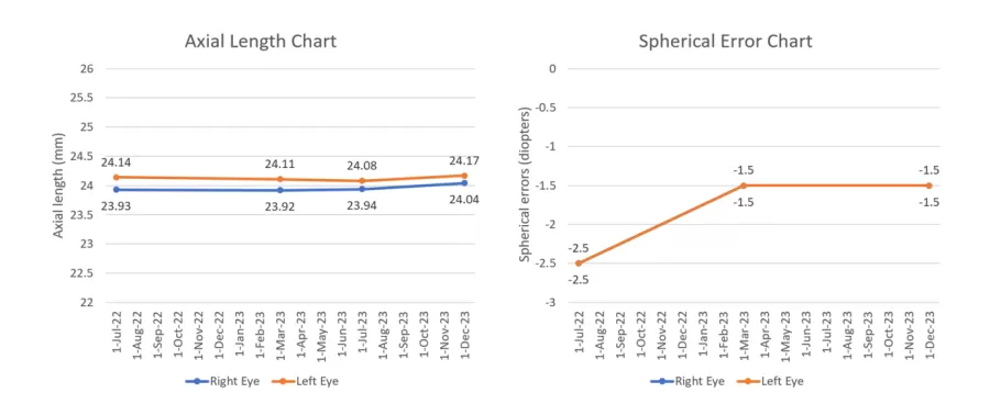 two graphies of myopia progression