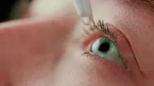 an image of eye drop in the eyes